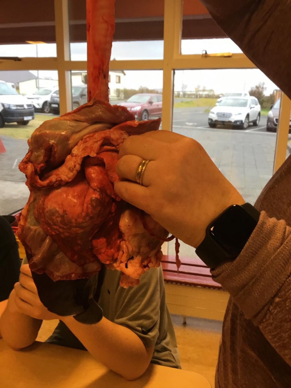 Líffærafræði á unglingastig